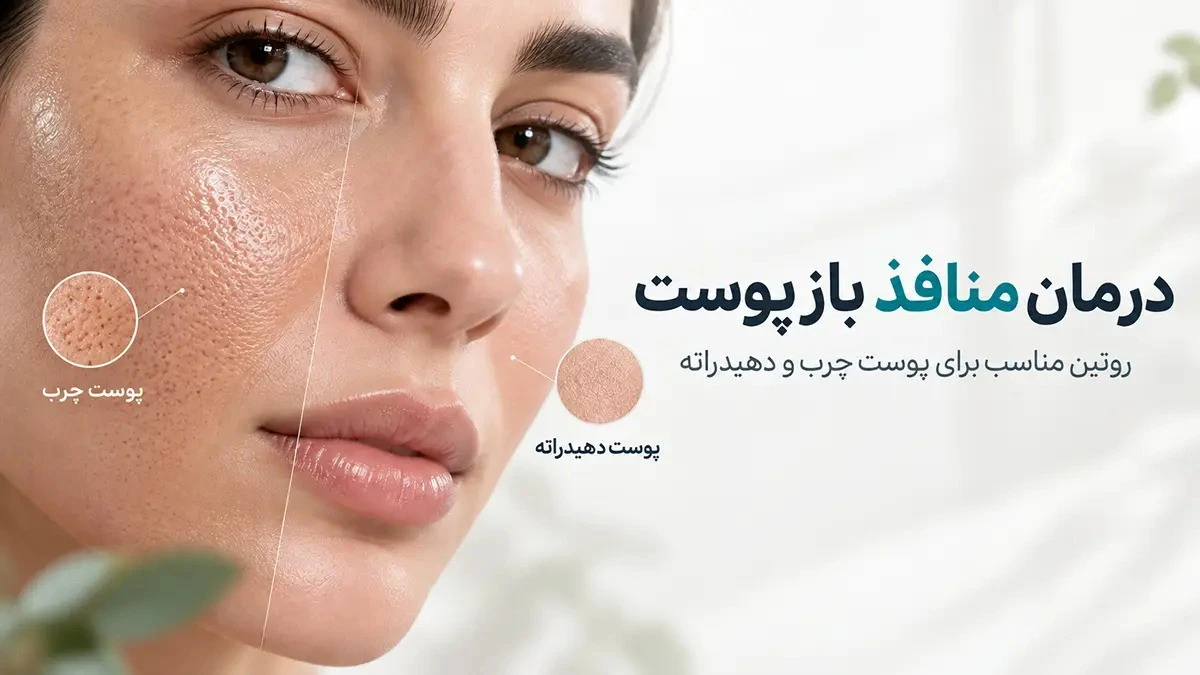 آیا منافذ باز پوست قابل درمان هستند؟