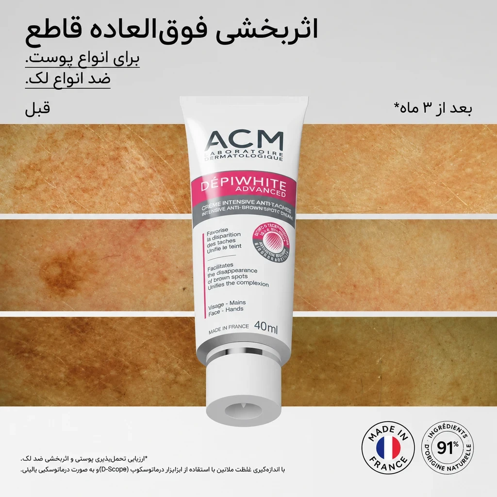 کرم ضدلک قوی دپی وایت ادونسد ACM