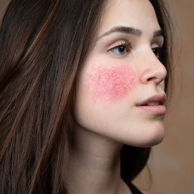 فواید هیالورونیک اسید برای پوست