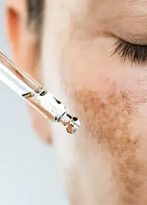 فواید نیاسینامید برای پوست